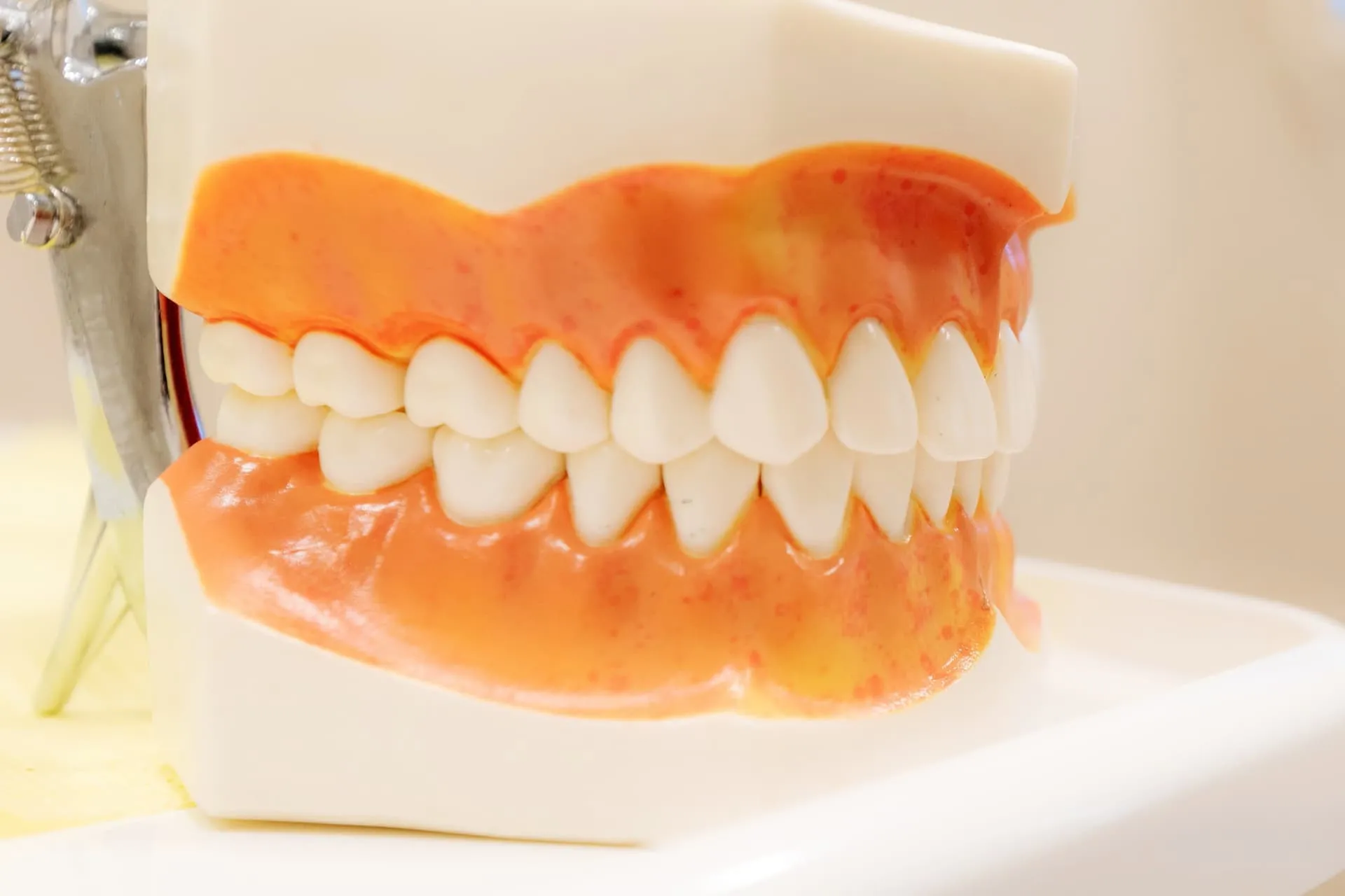 Modelo dental de arcadas superior e inferior en Clínica Dental Ladeira